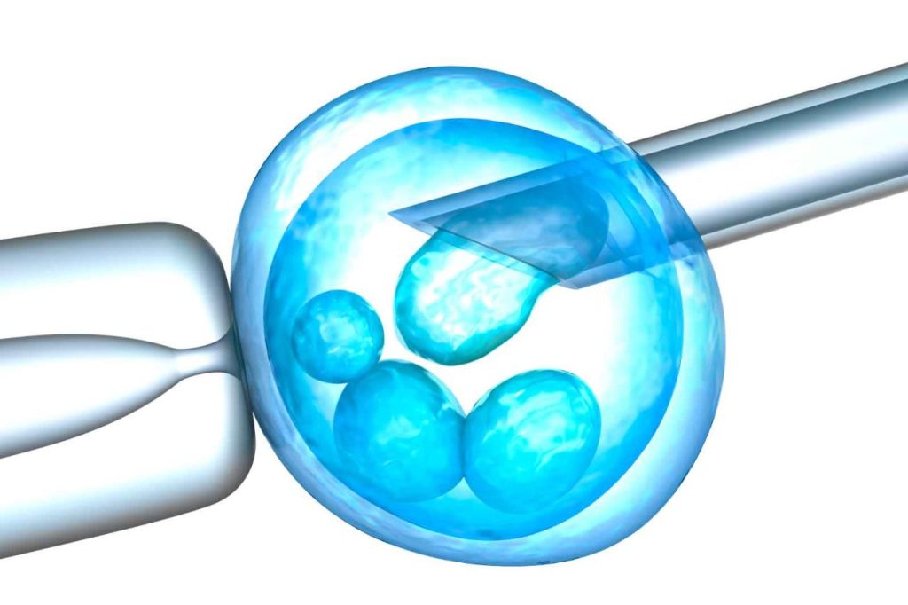 Ivf icsi sperm infertility