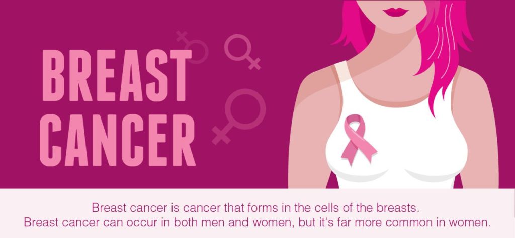 Breast cancer