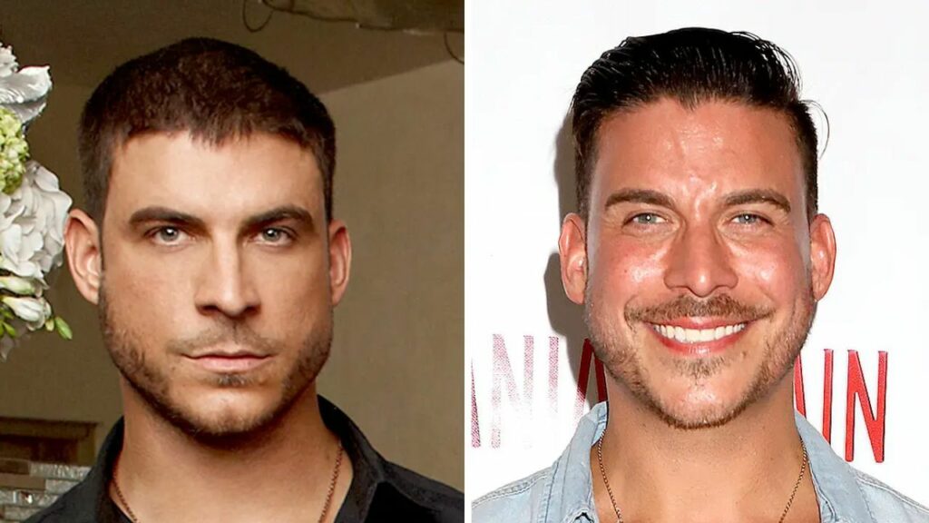 Jax taylor health